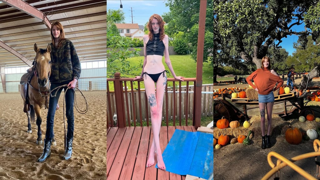 «Nadie es como yo»: La historia de la mujer con las piernas más largas que inspira al mundo post thumbnail image
