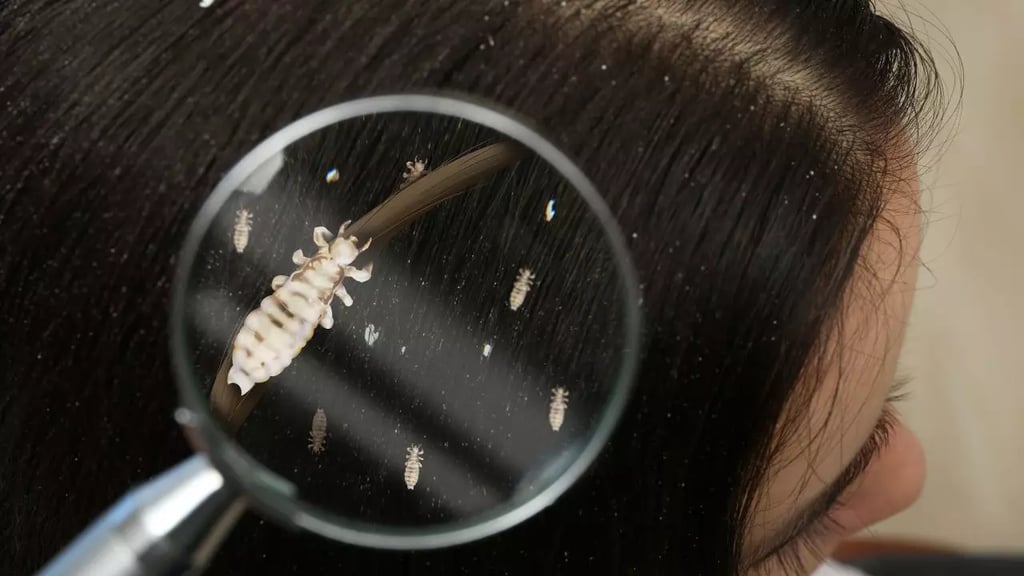 El ADN antiguo revela cómo un patógeno empezó a utilizar piojos para infectar humanos post thumbnail image