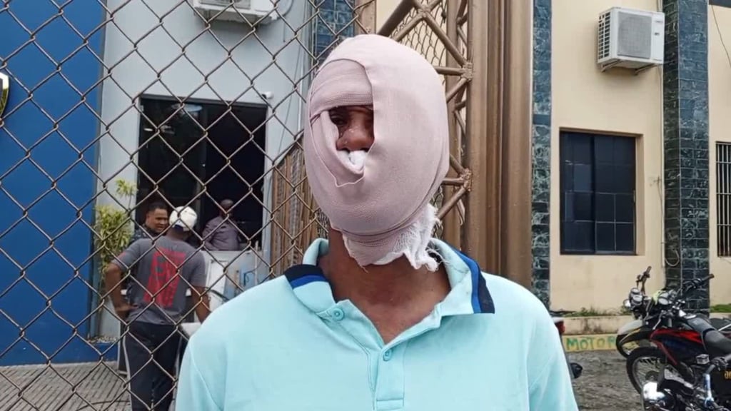 Por 200 pesos queman rostro a hombre con sancocho hirviendo en Santiago post thumbnail image
