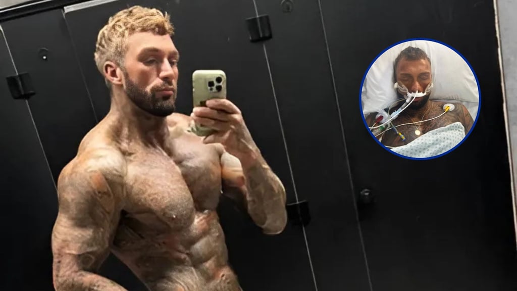 Fisicoculturista casi muere tras abusar de esteroides y llevar dieta obsesiva post thumbnail image
